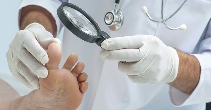 Dijagnostički pregled noktiju na nogama