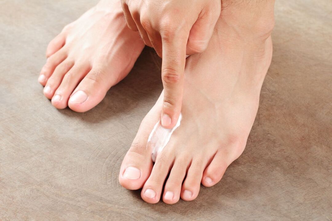 liječenje gljivica na stopalima mašću