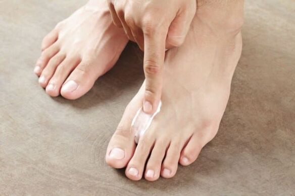 nanošenje masti od gljivica kože na nogama