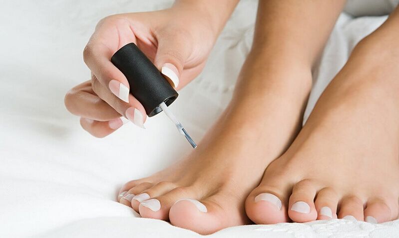 nanošenje laka za liječenje gljivica na noktima na nogama