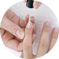 nanošenje laka za nokte za liječenje gljivica na noktima